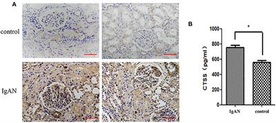 The Clinical Significance and Potential Role of Cathepsin S in IgA Nephropathy